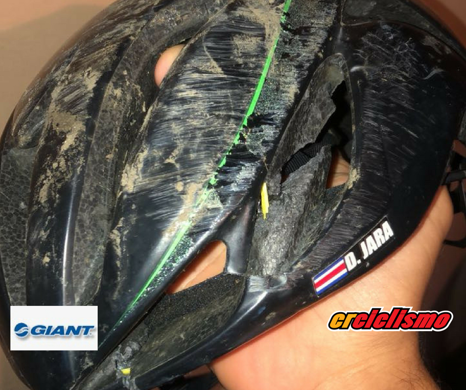 Casco salvo la vida de Daniel Jara a tan solo días de la Vuelta a la Juventud