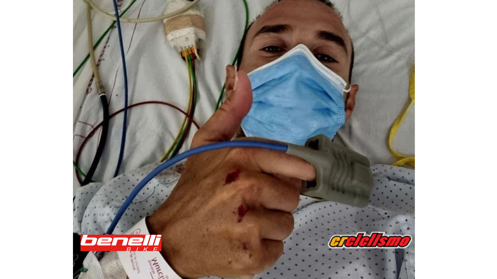Vehículo atropella a Valverde y su grupeta y se da a la fuga